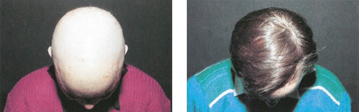 Why THYMUSKIN？ 我們為何推薦 THYMUSKIN？ @董哥的家 iwanthair's blog