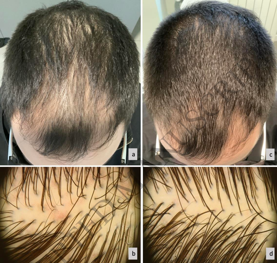 關於紛永維(Finjuve)二三事 @董哥的家 iwanthair's blog