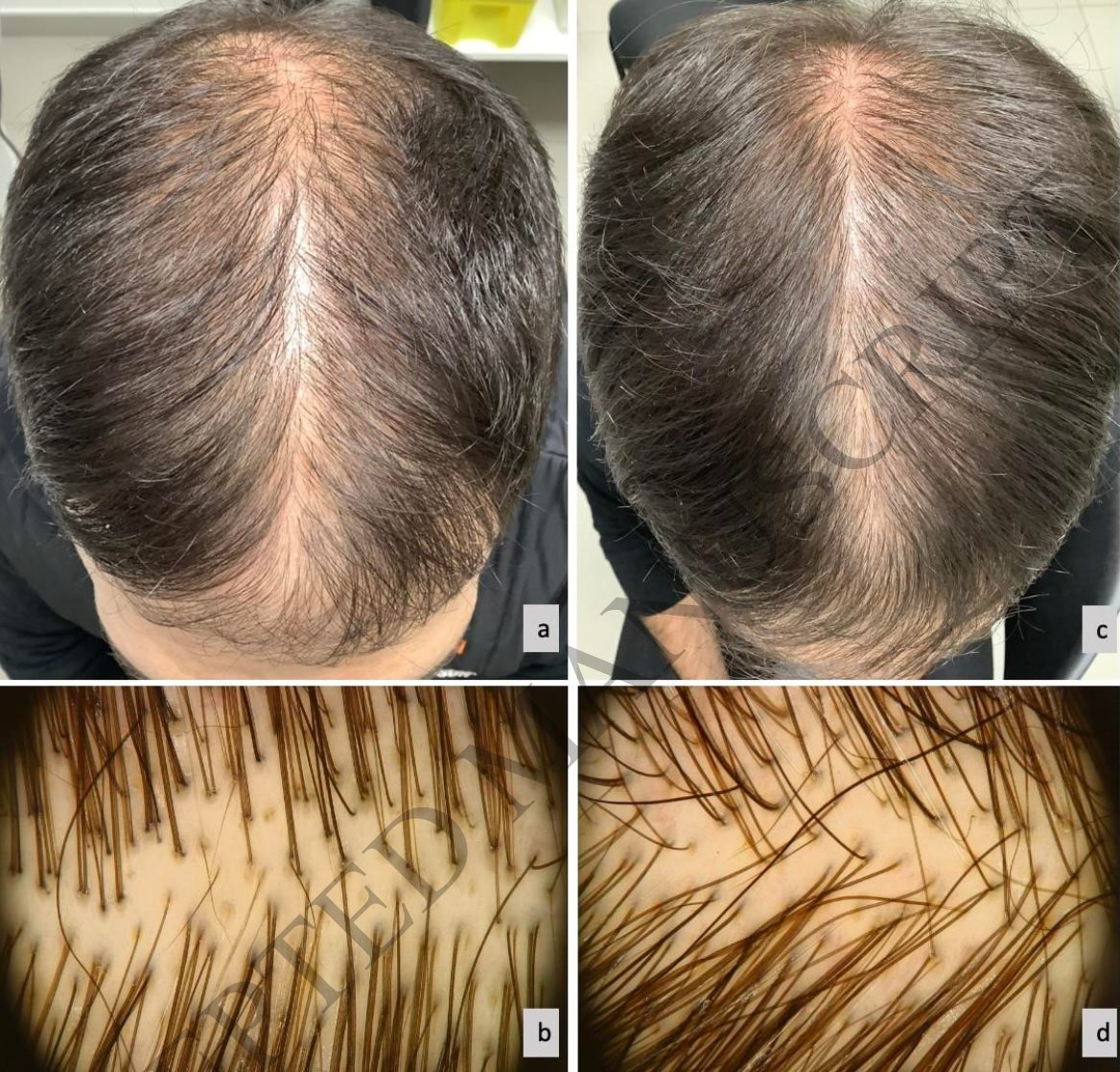 關於紛永維(Finjuve)二三事 @董哥的家 iwanthair's blog