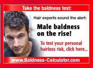 德國科學家首創『禿頭計算器』 預測男士何時脫髮 @董哥的家 iwanthair&#039;s blog