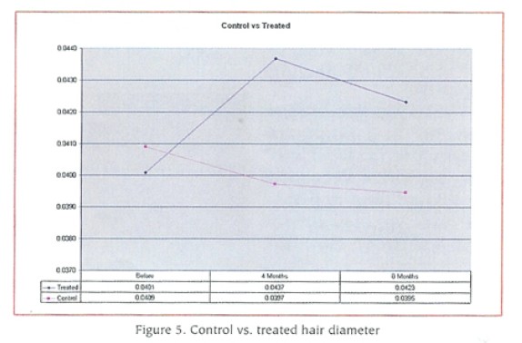 自體血小板豐富血漿(PRP)與多種生長因子應用在非植髮手術的生髮研究(下) @董哥的家 iwanthair&#039;s blog