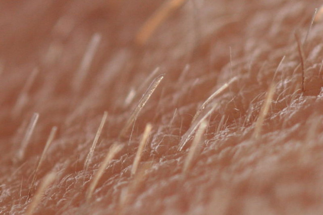 FDA 批准第一個治療圓禿(斑禿)的口服藥 @董哥的家 iwanthair&#039;s blog