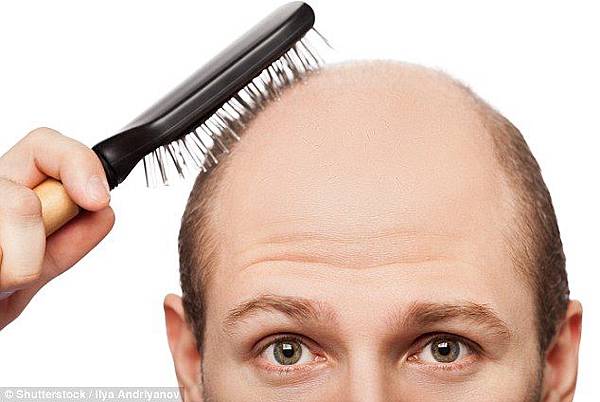 禿頭？新的療法有辦法使頭髮重新長回來 @董哥的家 iwanthair&#039;s blog