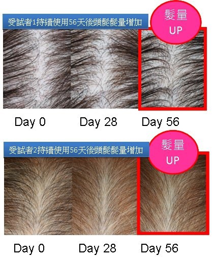抗FGF-5落髮因子與毛髮生長的關聯性 (三) &#8211; 評估advangen療效的安慰劑對照研究 @董哥的家 iwanthair&#039;s blog